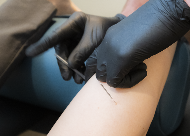 Dry Needling at Broken Arrow LifeMotion - LifeMotion